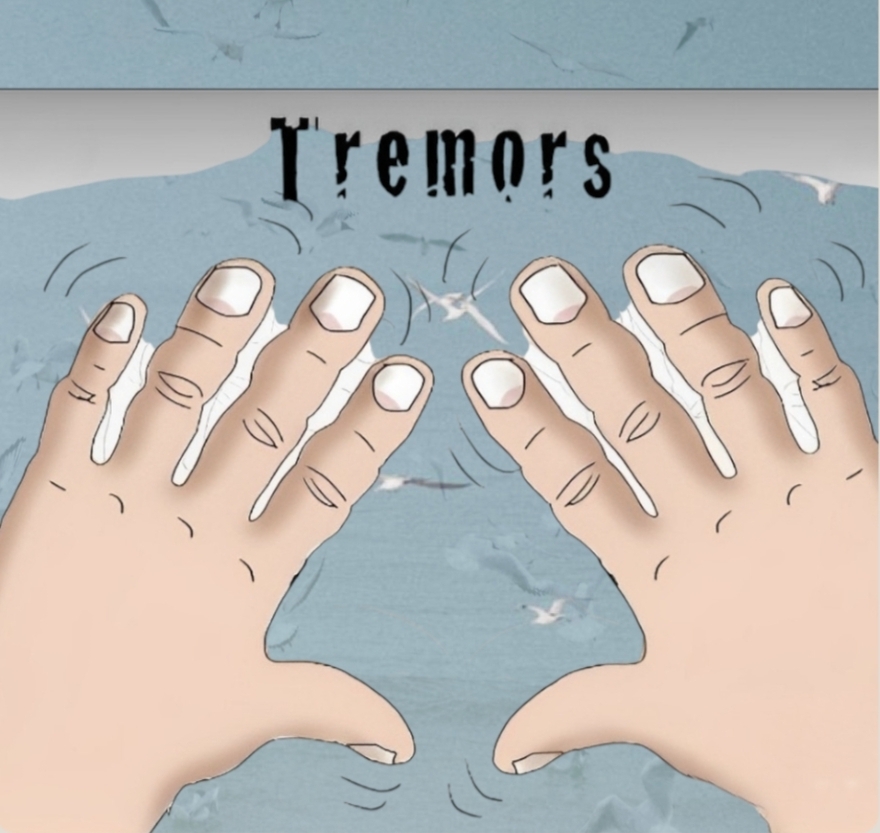 Tremor